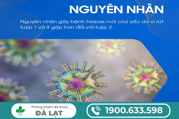 Hình ảnh minh họa